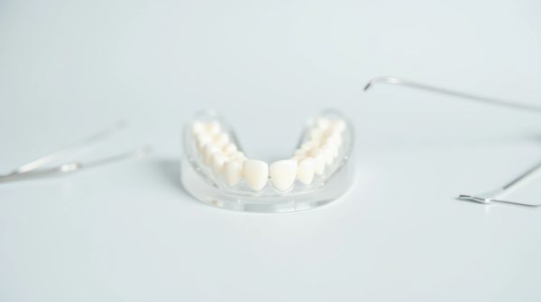 Aligner ses dents : ce que vous ne saviez pas sur les traitements